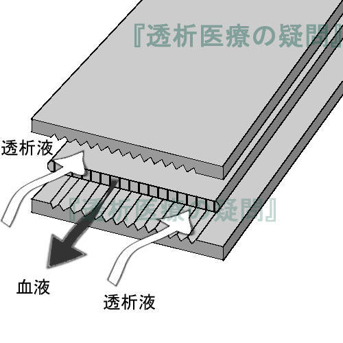 積層型の構造イメージ図
